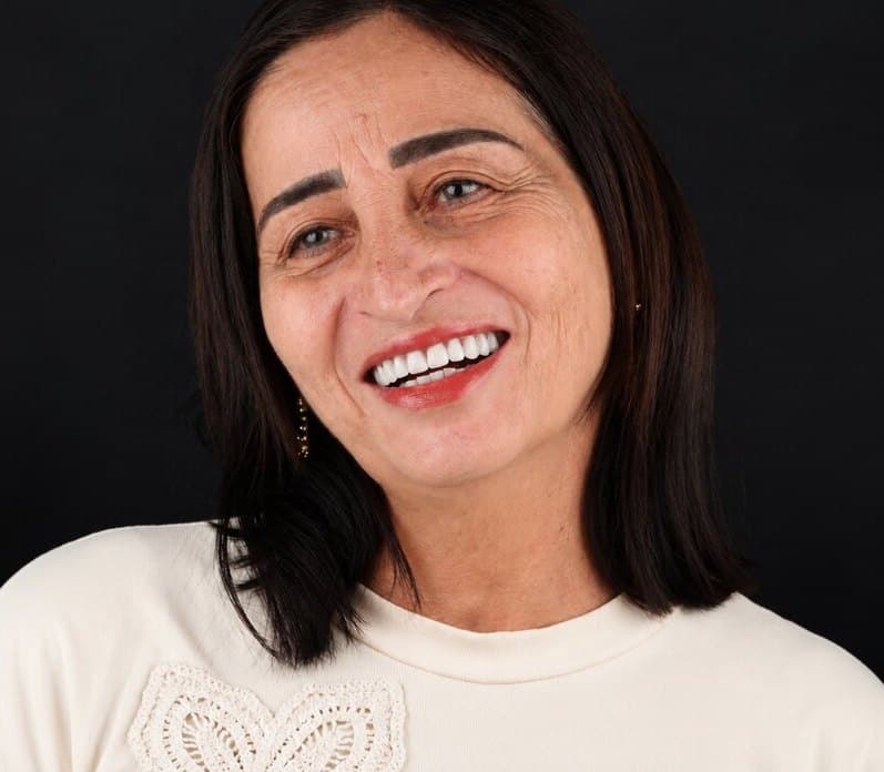 Depois: sorriso de uma paciente com prótese dentária na Clínica Vita Implantes